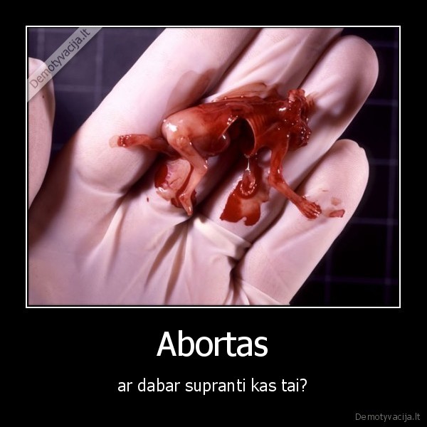 Abortas - ar dabar supranti kas tai?