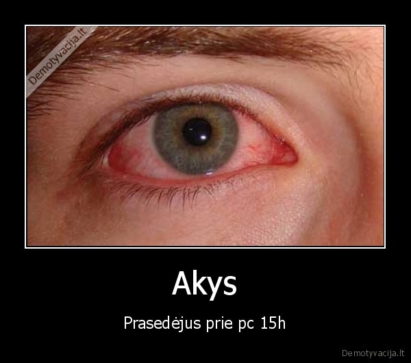 Akys - Prasedėjus prie pc 15h