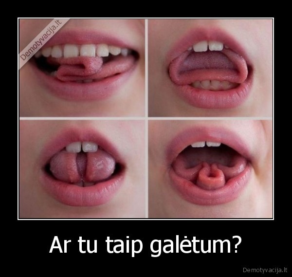 Ar tu taip galėtum? - 