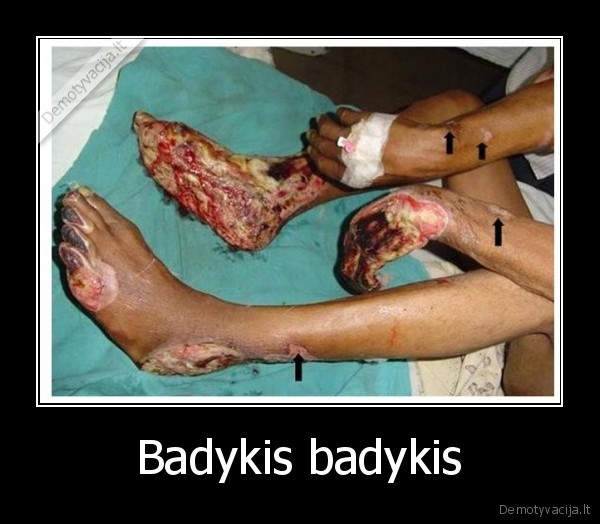 Badykis badykis - 