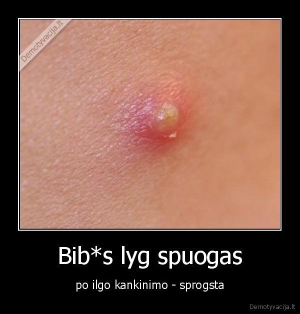 Bib*s lyg spuogas - po ilgo kankinimo - sprogsta