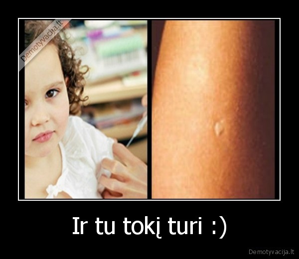 Ir tu tokį turi :) - 