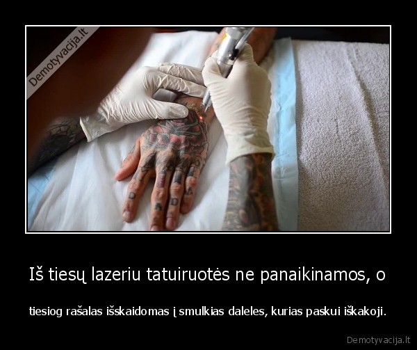 Iš tiesų lazeriu tatuiruotės ne panaikinamos, o - tiesiog rašalas išskaidomas į smulkias daleles, kurias paskui iškakoji.