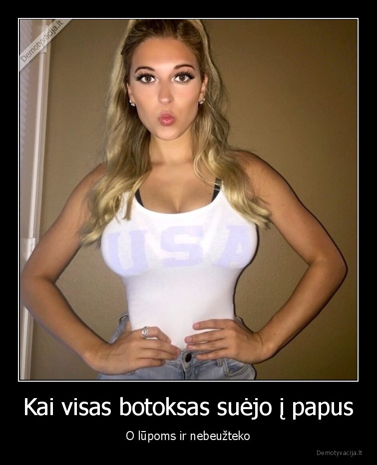 Kai visas botoksas suėjo į papus - O lūpoms ir nebeužteko