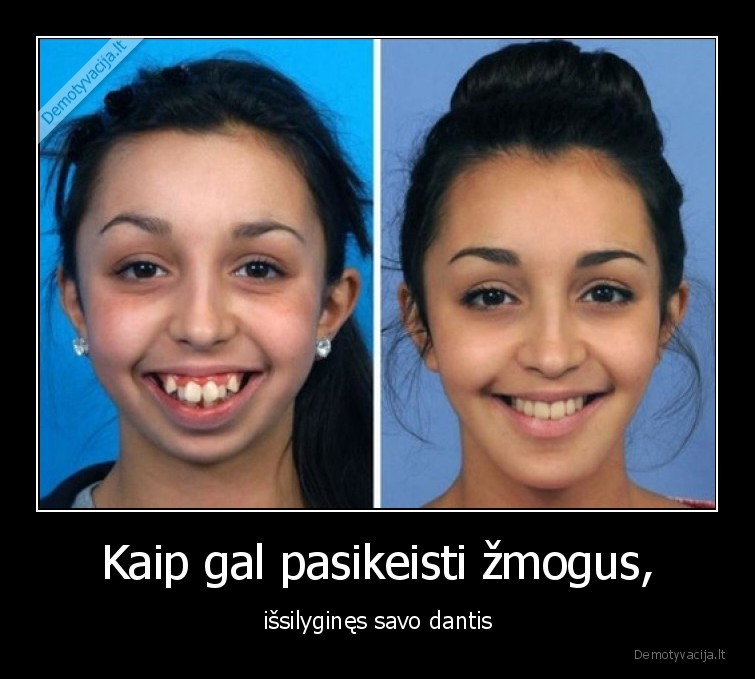 Kaip gal pasikeisti žmogus, - išsilyginęs savo dantis