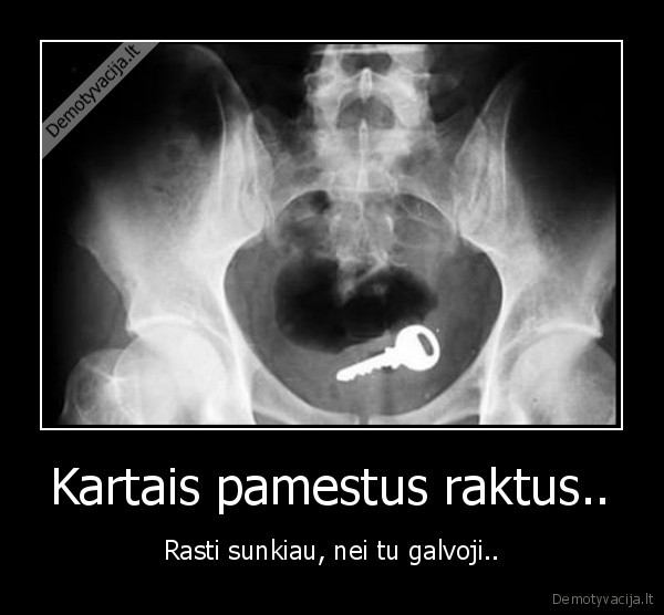 Kartais pamestus raktus.. - Rasti sunkiau, nei tu galvoji..