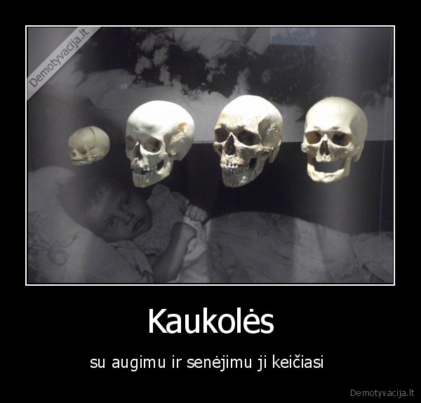 Kaukolės - su augimu ir senėjimu ji keičiasi 