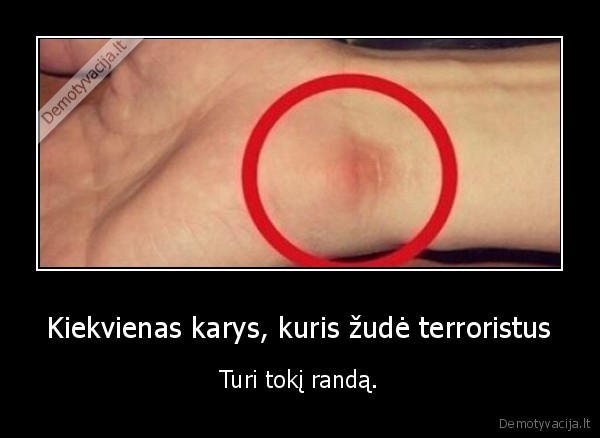 Kiekvienas karys, kuris žudė terroristus - Turi tokį randą.