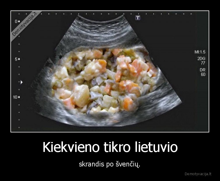 Kiekvieno tikro lietuvio - skrandis po švenčių.