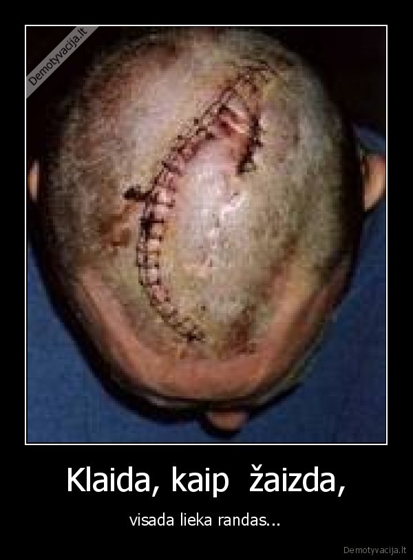 Klaida, kaip  žaizda, - visada lieka randas...
