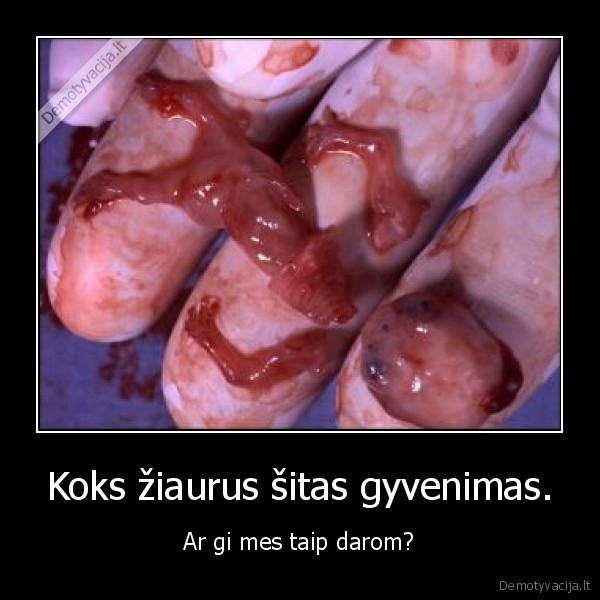 Koks žiaurus šitas gyvenimas. - Ar gi mes taip darom?