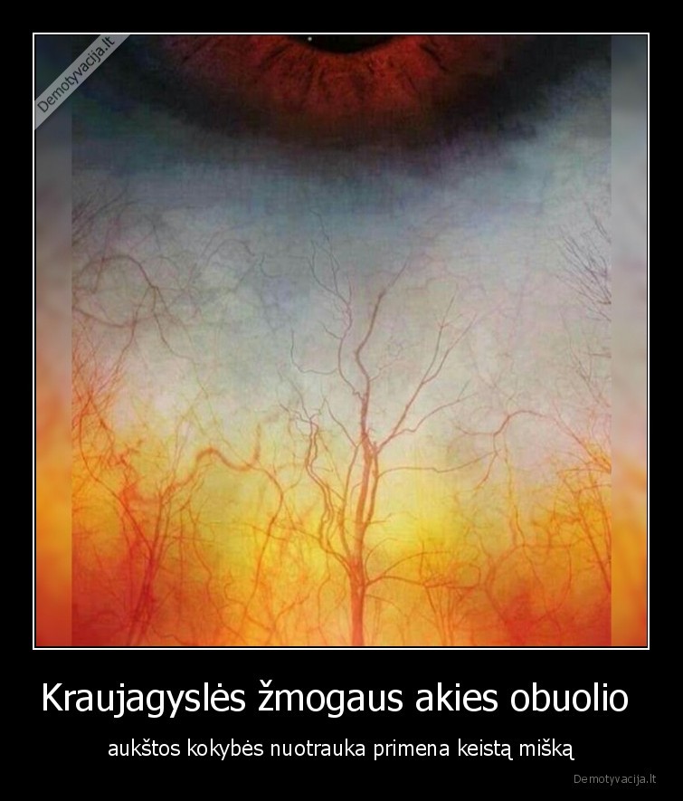 Kraujagyslės žmogaus akies obuolio  - aukštos kokybės nuotrauka primena keistą mišką