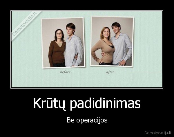 Krūtų padidinimas - Be operacijos