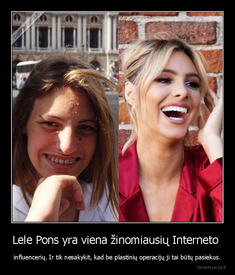 Lele Pons yra viena žinomiausių Interneto  - influencerių. Ir tik nesakykit, kad be plastinių operacijų ji tai būtų pasiekus.