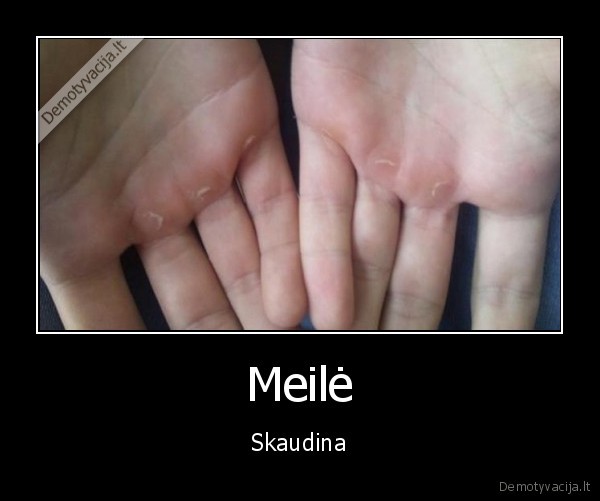 Meilė - Skaudina