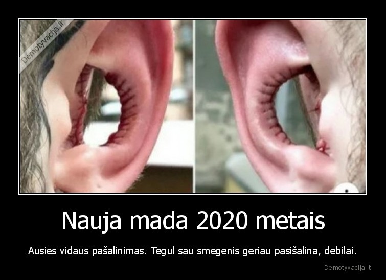 Nauja mada 2020 metais - Ausies vidaus pašalinimas. Tegul sau smegenis geriau pasišalina, debilai.