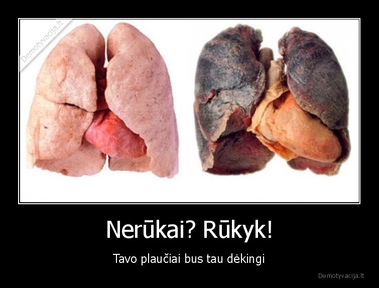 Nerūkai? Rūkyk! - Tavo plaučiai bus tau dėkingi