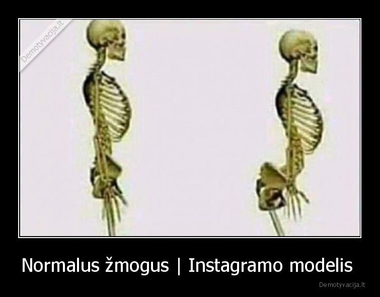 Normalus žmogus | Instagramo modelis  - 