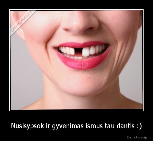 Nusisypsok ir gyvenimas ismus tau dantis :) - 