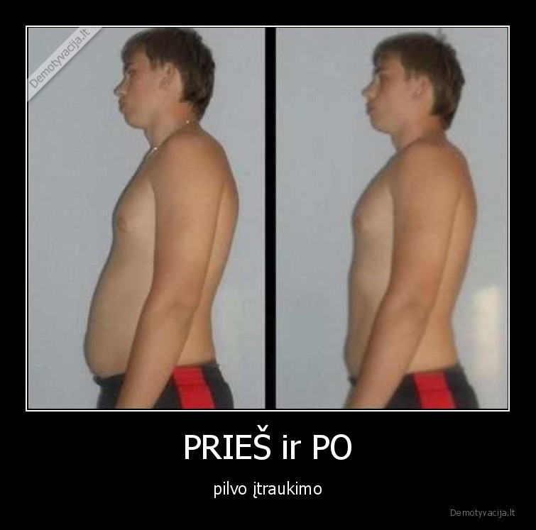 PRIEŠ ir PO - pilvo įtraukimo