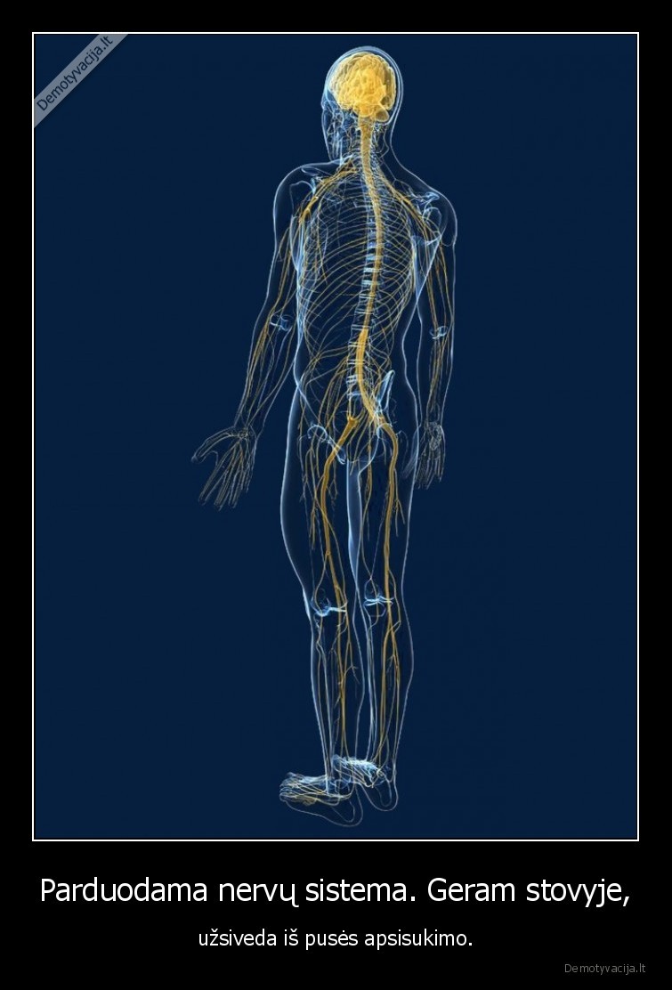 Parduodama nervų sistema. Geram stovyje, - užsiveda iš pusės apsisukimo.