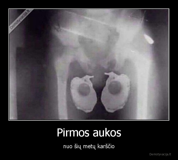 Pirmos aukos - nuo šių metų karščio