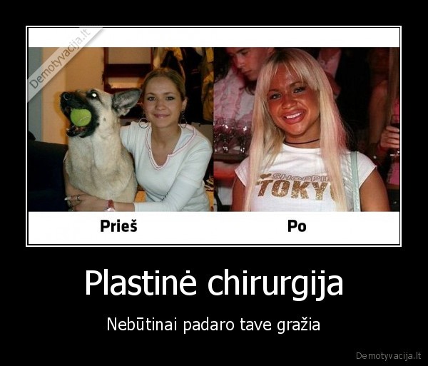 Plastinė chirurgija - Nebūtinai padaro tave gražia