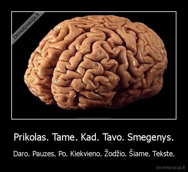 Prikolas. Tame. Kad. Tavo. Smegenys. - Daro. Pauzes. Po. Kiekvieno. Žodžio. Šiame. Tekste.