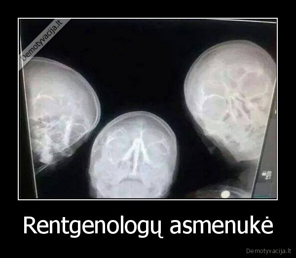 Rentgenologų asmenukė - 