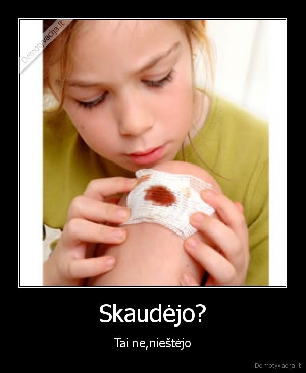 Skaudėjo? - Tai ne,nieštėjo