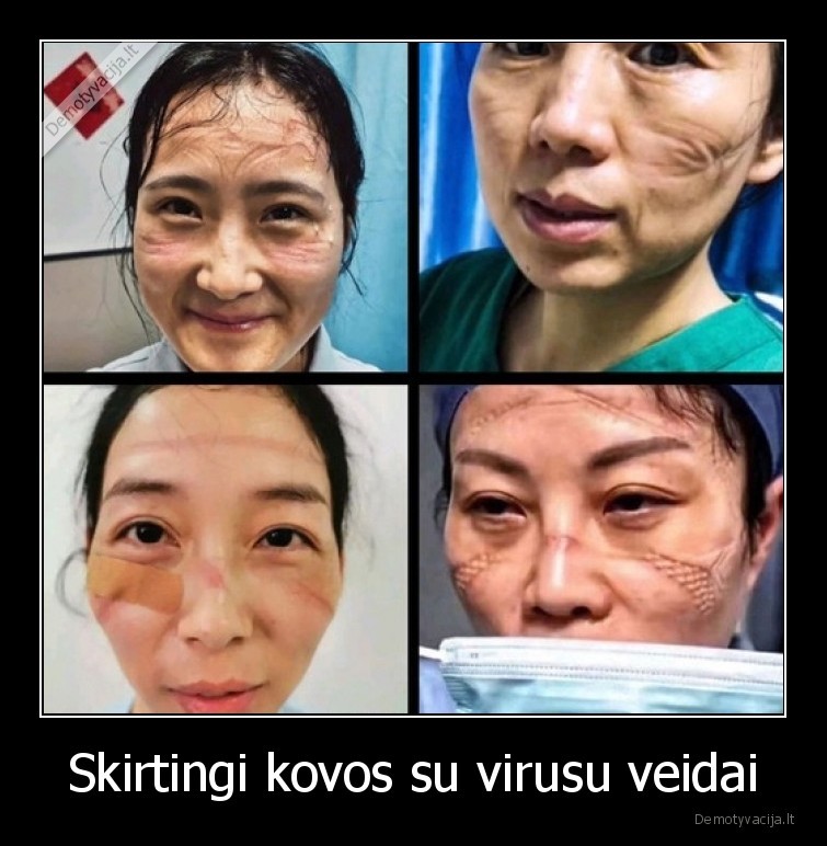 Skirtingi kovos su virusu veidai - 