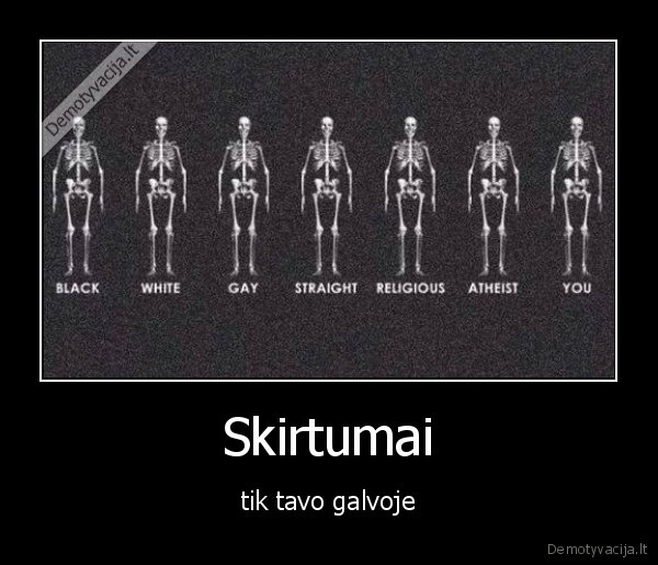 Skirtumai - tik tavo galvoje