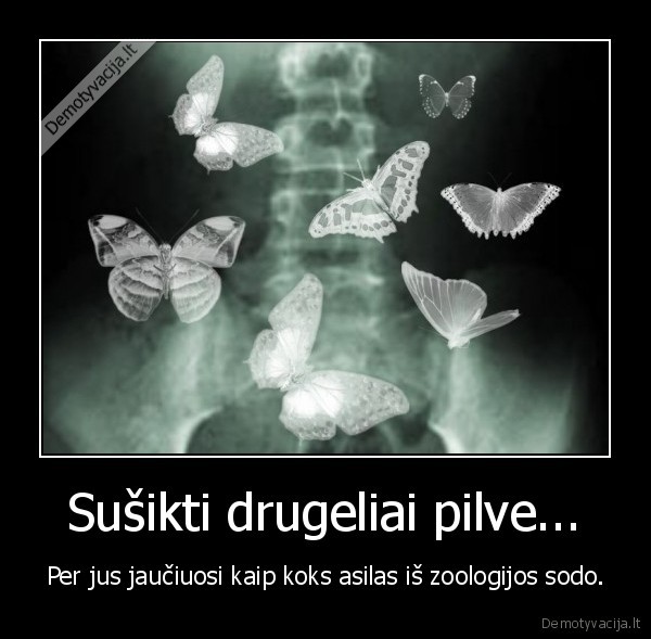 Sušikti drugeliai pilve... - Per jus jaučiuosi kaip koks asilas iš zoologijos sodo.