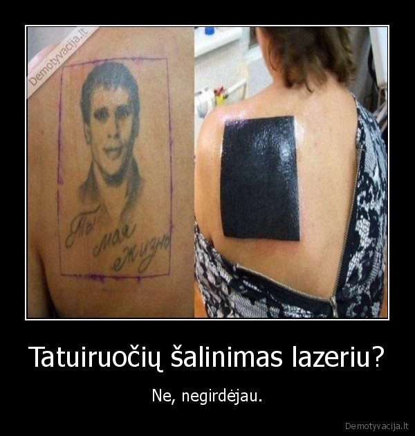 Tatuiruočių šalinimas lazeriu? - Ne, negirdėjau.