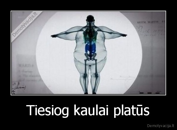 Tiesiog kaulai platūs - 