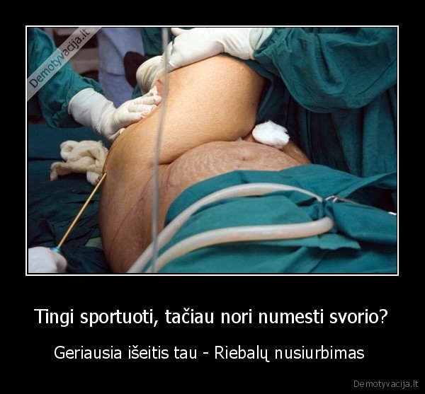 Tingi sportuoti, tačiau nori numesti svorio? - Geriausia išeitis tau - Riebalų nusiurbimas 