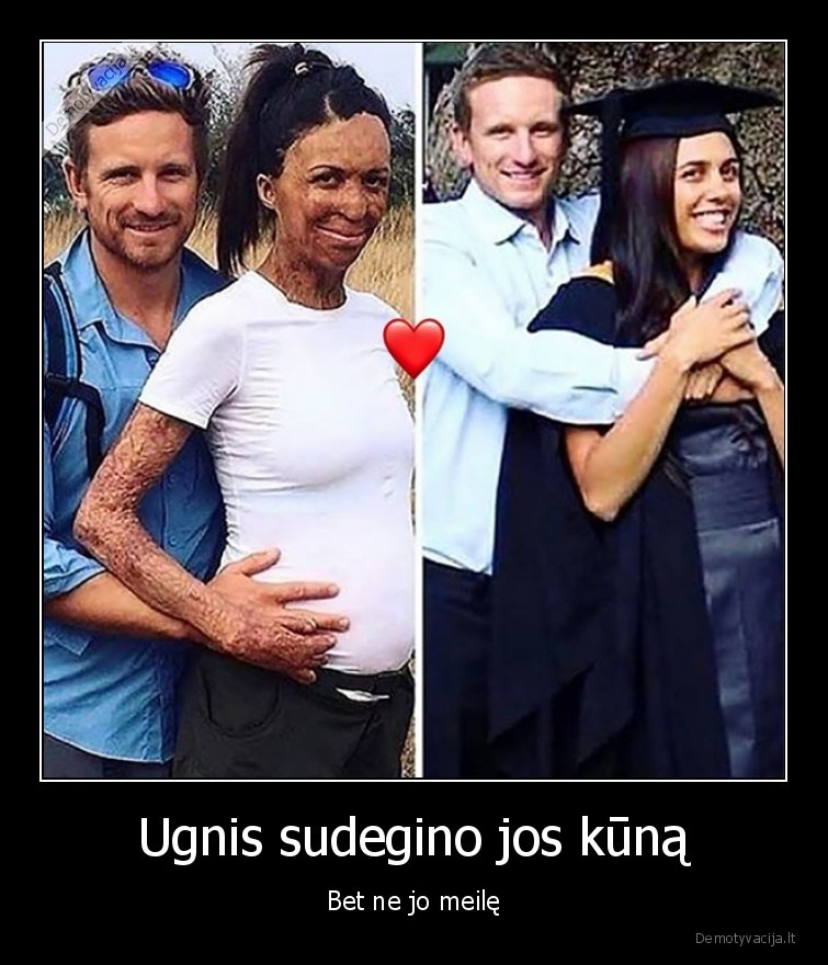 Ugnis sudegino jos kūną - Bet ne jo meilę