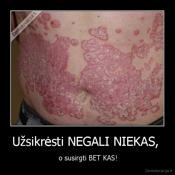 Užsikrėsti NEGALI NIEKAS,  -  o susirgti BET KAS!