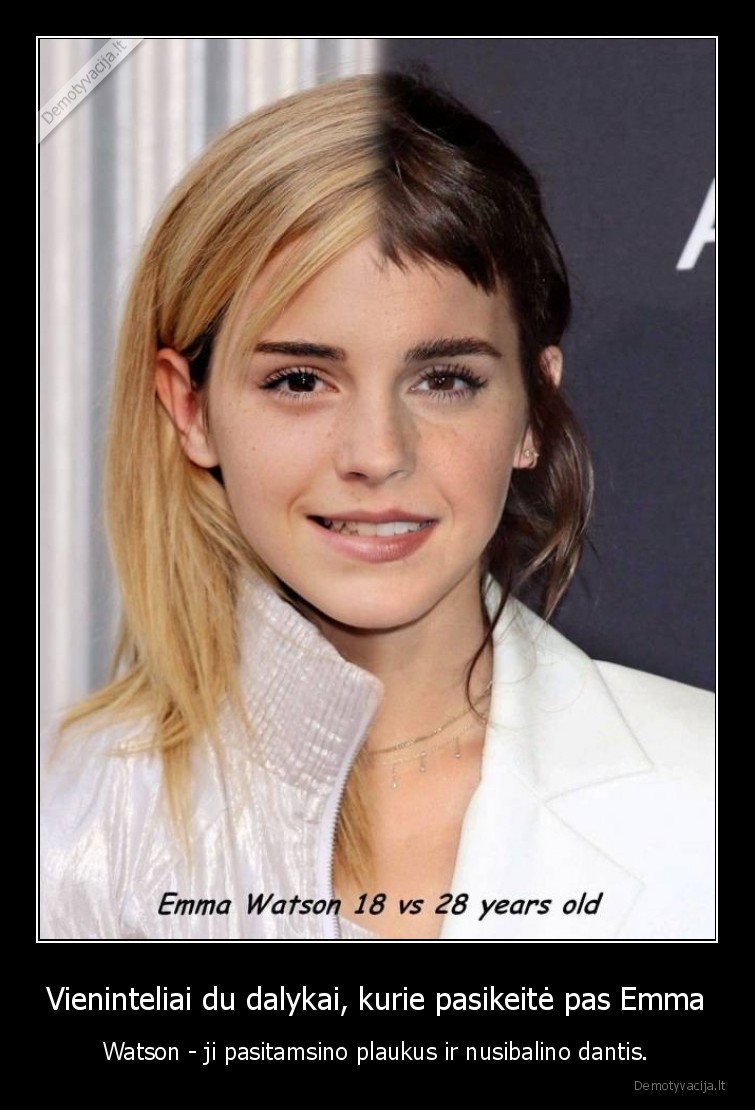 Vieninteliai du dalykai, kurie pasikeitė pas Emma - Watson - ji pasitamsino plaukus ir nusibalino dantis.