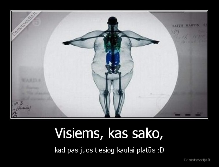 Visiems, kas sako, - kad pas juos tiesiog kaulai platūs :D