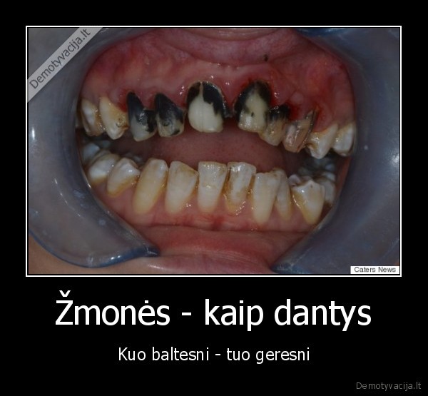 Žmonės - kaip dantys - Kuo baltesni - tuo geresni